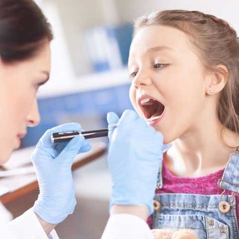 دندان کوسه ای در کودکان چیست؟