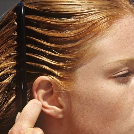 درمان ریزش مو در زنان با تکنیک های مدرن