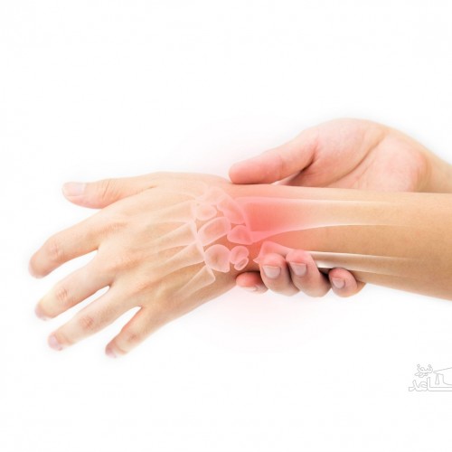 روش ها و حرکت های ورزشی برای تقویت تاندون مچ دست