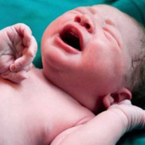 (عکس) تصویر لحظه به دنیا آمدن یک نوزاد جهانی شد
