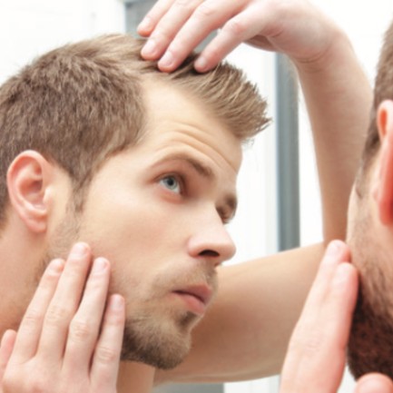 علت ریزش موی پیشانی در مردان