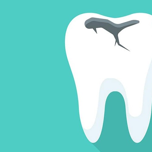 علت زرد شدن دندان ها چیست؟