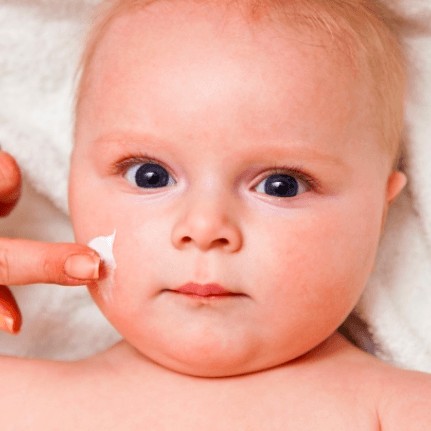قارچ پوستی در کودک چیست؟