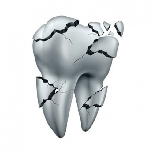خطرات درمان ریشه ی دندان چیست؟