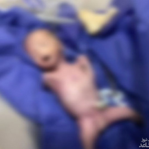 کشف عجیب جسد نوزاد نارس در بخش کرونای بیمارستان امام رضا مشهد