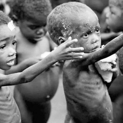 Malnutrition, Poverty and Health Crisis in Twenties