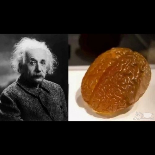 مغز اینشتین در حال حاضر کجاست؟ +عکس
