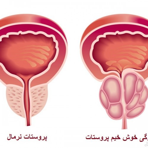 میزان، تاثیرات و مکانیزم اثر  زیتیگا