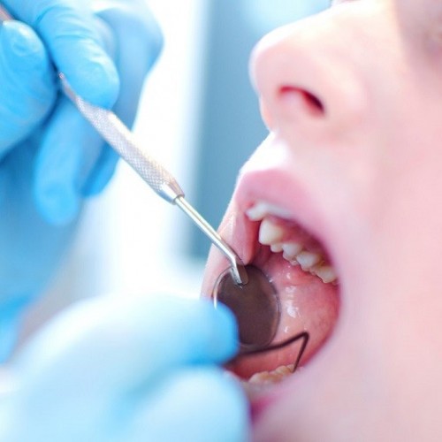 مراقبت های لازم پس از کشیدن دندان شیری کودک