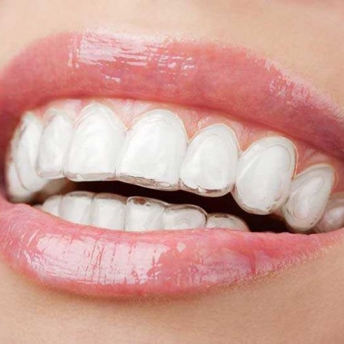 مشکلات رایج دهان و دندان که باید بدانید!