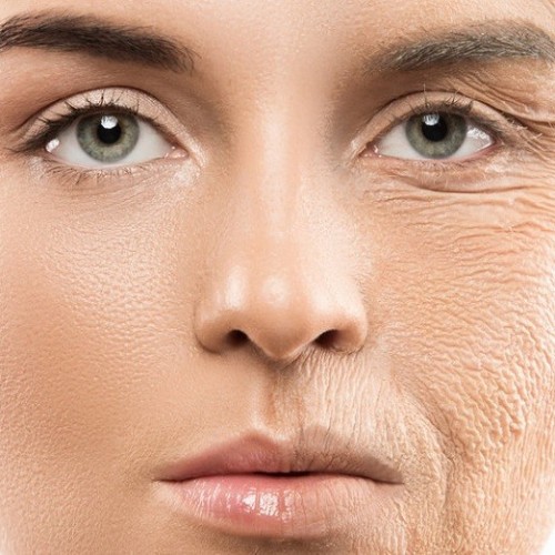 نحوه انجام بازسازی پوست برای جلوگیری از پیری زودرس