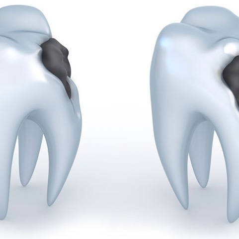 نحوه ی پیشگیری از دندان ‌درد با راهکار های آسان