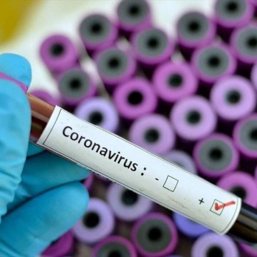 New Kit Unveiled for Diagnosis of Coronavirus Infection