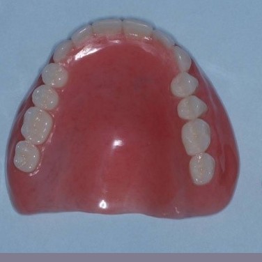 نکاتی مهم درباره ی پروتز دندان یا دندان مصنوعی