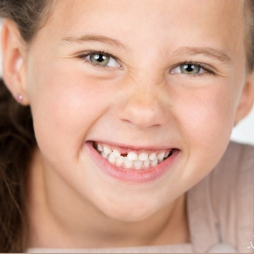 اکلوژن چیست؟