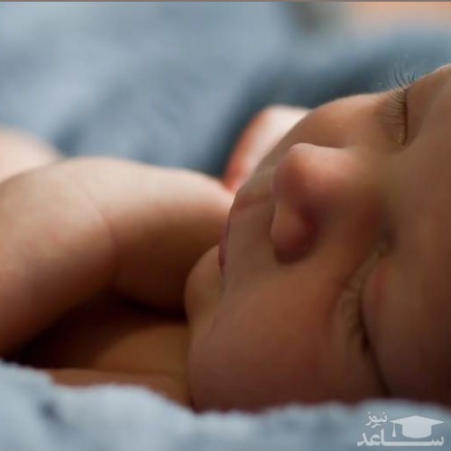 روش‌های پیشگیری از درماتیت سبوره در نوزادان چیست؟