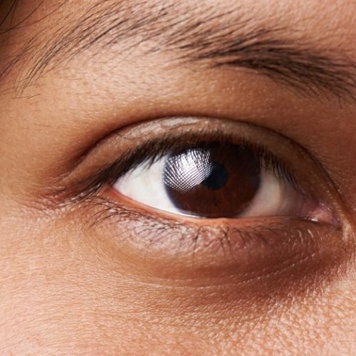 روش های طبیعی برای درمان سیاهی دور چشم