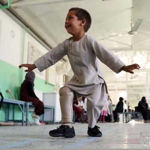 (فیلم) رقص خوشحالی کودک افغانستانی پس از دریافت پای مصنوعی