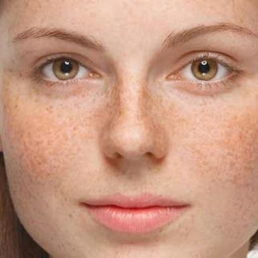 صاف کننده های شیمیایی مو چیست؟