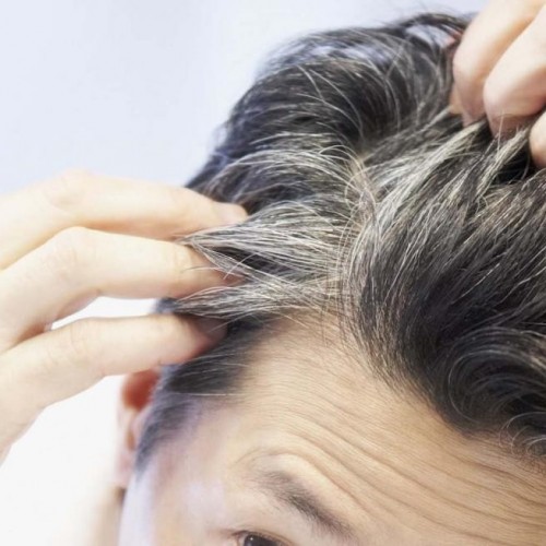 شایع ترین دلایل ریزش مو در مردان