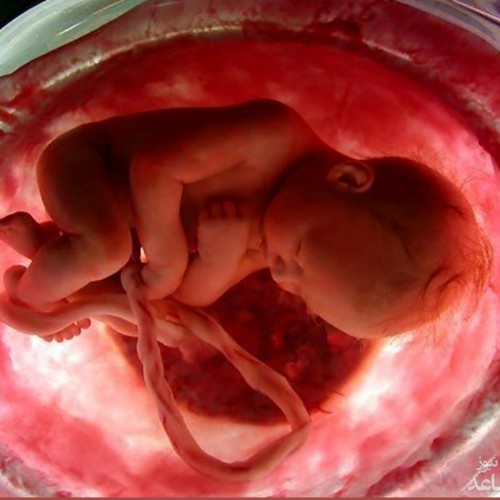 سقط جنین ۲۰برابر تلفات سوانح رانندگی در ایران!