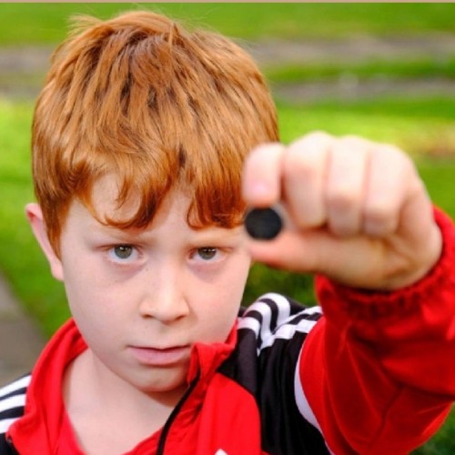 سرنوشت عجیب کودکی که باتری قورت داد!