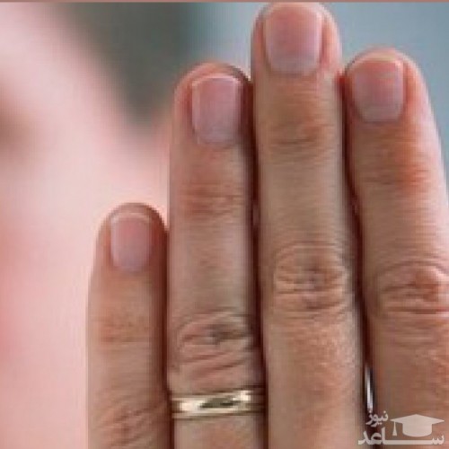 تاثیر طول انگشت حلقه بر افزایش فوتی‌ها بر اثر کرونا در مردان
