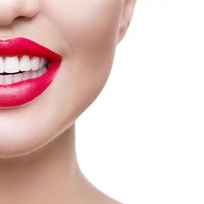 چند روش برای درمان فاصله بین دندان ها