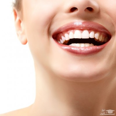 7 دلیل که باعث زردی دندان می شوند