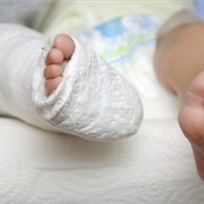 علائم و نشانه های شکستگی استخوان در کودکان