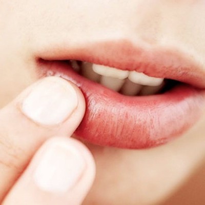 12 درمان خانگی برای آفت دهان