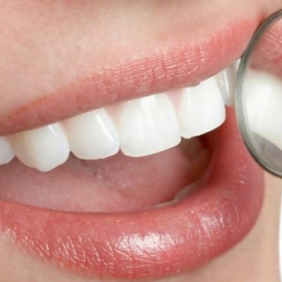 درمان پوسیدگی دندان با لیزر