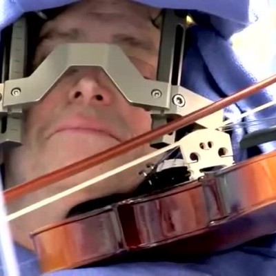 (فیلم) ویولن نوازی در هنگام عمل جراحی مغز