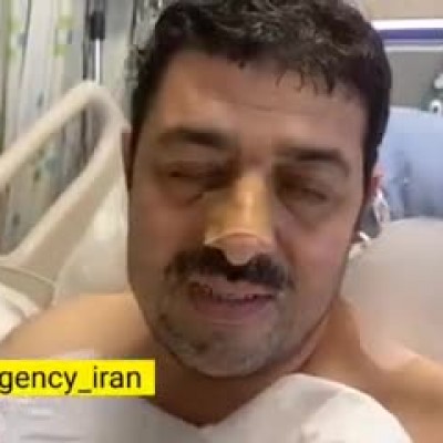 وضعیت رییس اورژانس کشور پس از ابتلا به کرونا